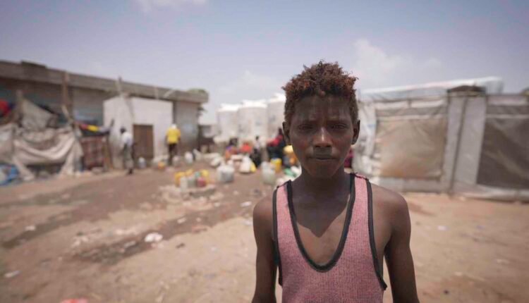 Displaced Young boy [2]