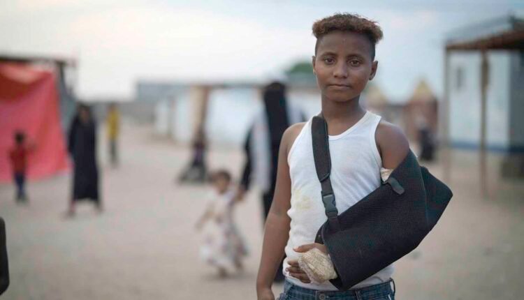 Displaced child [injured]