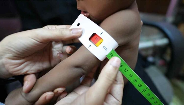 Measuring a malnourished Child [2]