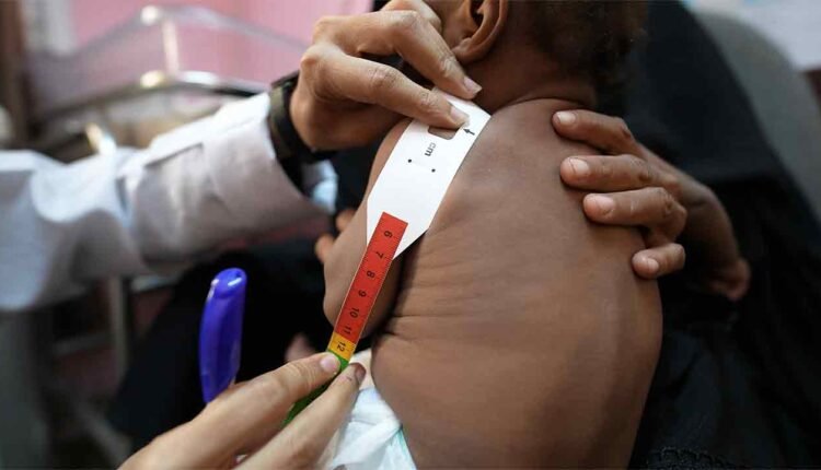 Measuring a malnourished Child