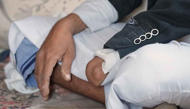 Landmine survivor ! [2]